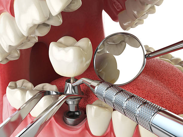 Best Emergency Dental Services for Seniors in Madill, OK